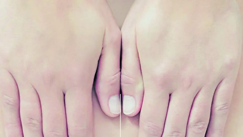 Carla Güibas, centre de fisioteràpia a Castelló d’Empúries