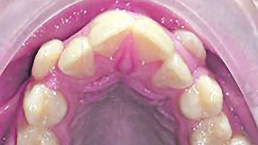 Dieta i salut bucodental